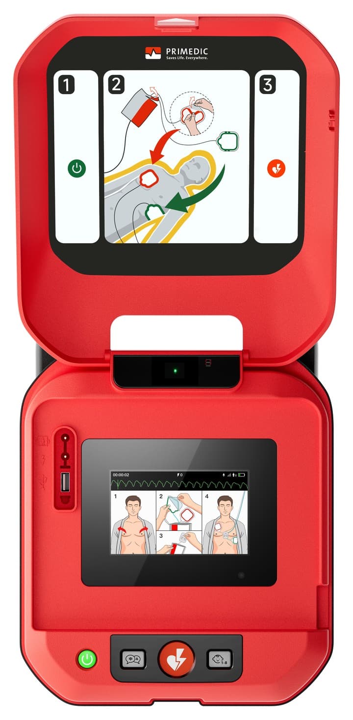 Yuwell Y2 — ตัวเครื่องเปิดฝาพร้อมใช้งาน